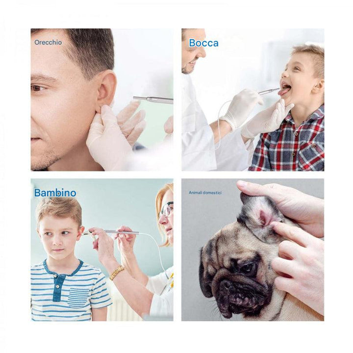 Otoscopio digitale con schermo da 4,5 pollici